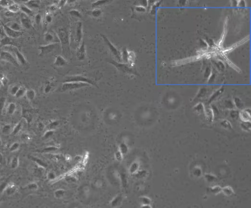 Abbildung 3 U2OS Zellen, frühes Stadium einer Kontamination mit Bakterien. Aufgenommen mit ZEISS Axiovert 5 digital.